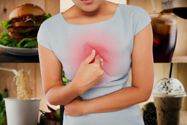 Everything You Need to Know About Heartburn