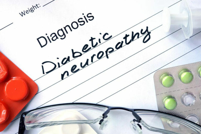 Everything You Need to Know about Diabetic Neuropathy