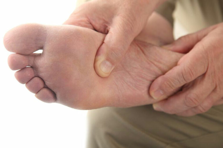 Everything You Need to Know about Plantar Fasciitis