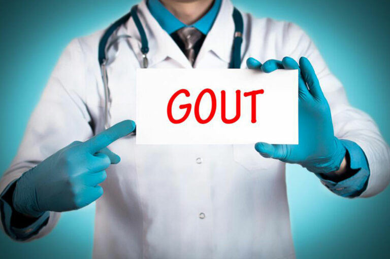 Easy Gout Remedies to Help Manage Pain