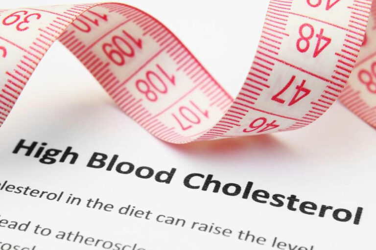 Easy Steps for Cholesterol Level Diagnosis