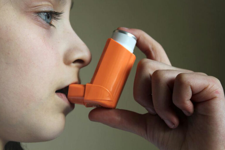 Effective Tips to Treat Asthma