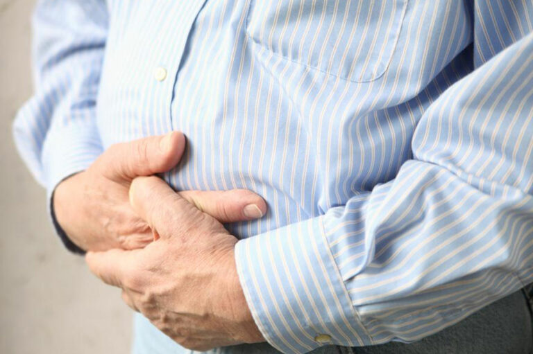 Essential Guidelines to manage Diverticulitis