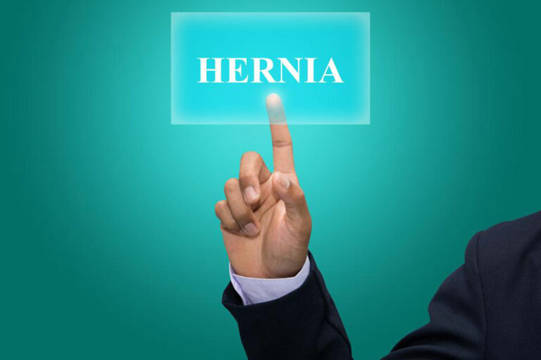 Find the Best Hernia Treatment for You