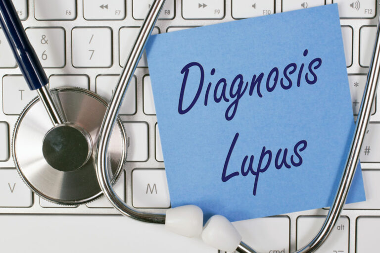 First Symptoms of Lupus to Watch Out For