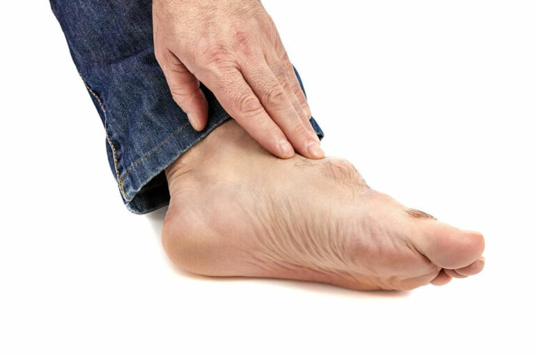 Gout &#8211; Causes, Symptoms, Treatment, and Diet Plans