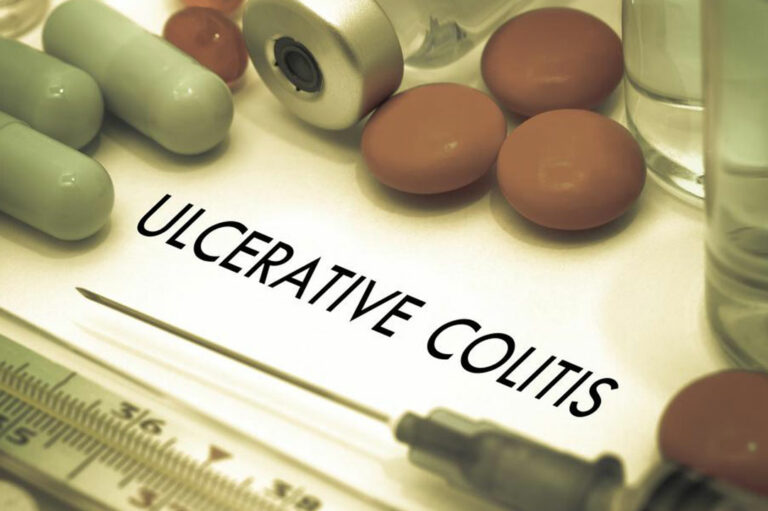 Here Are Some of the Popular Ulcerative Colitis Treatments