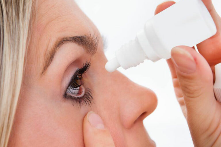 Here Are a Few Things to Know about Dry Eyes