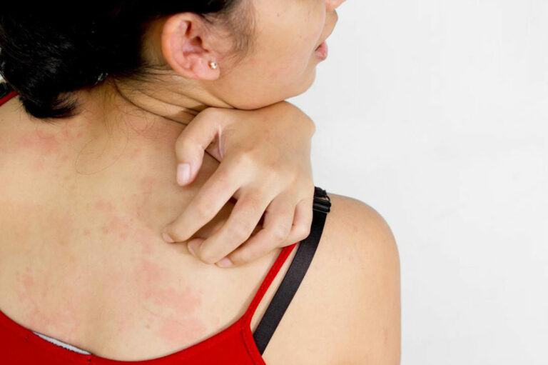 Here are a few common causes of itchy skin