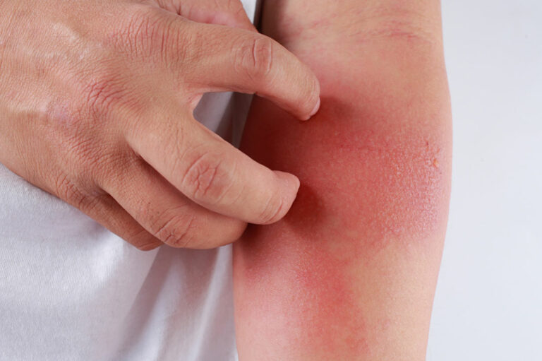 Here&#8217;s How to Identify a Skin Rash