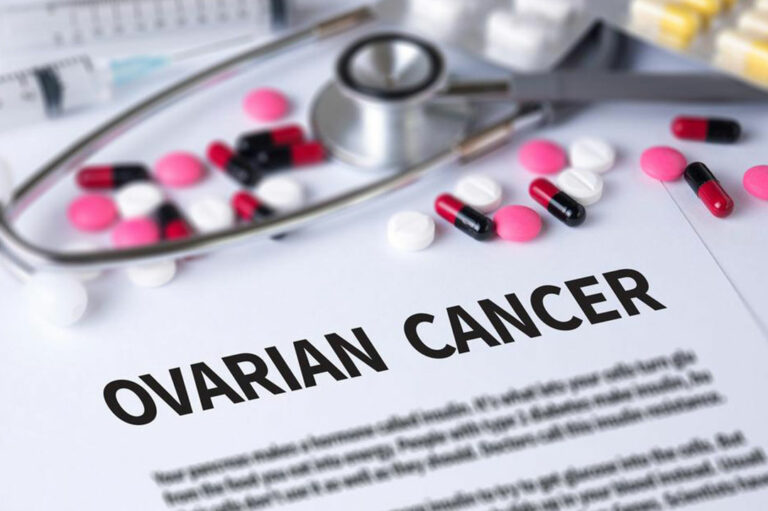 Here’s What You Need to Know about Ovarian Cancer