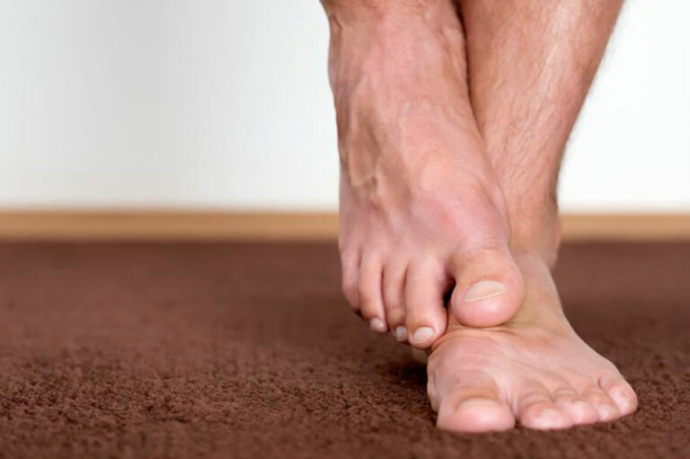 How Diabetes Causes Foot Problems