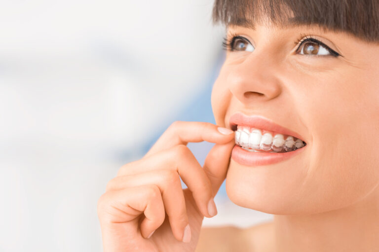 How and why are crowded teeth fixed