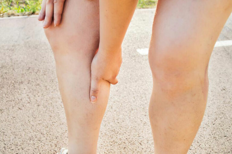 How cholesterol causes leg problems