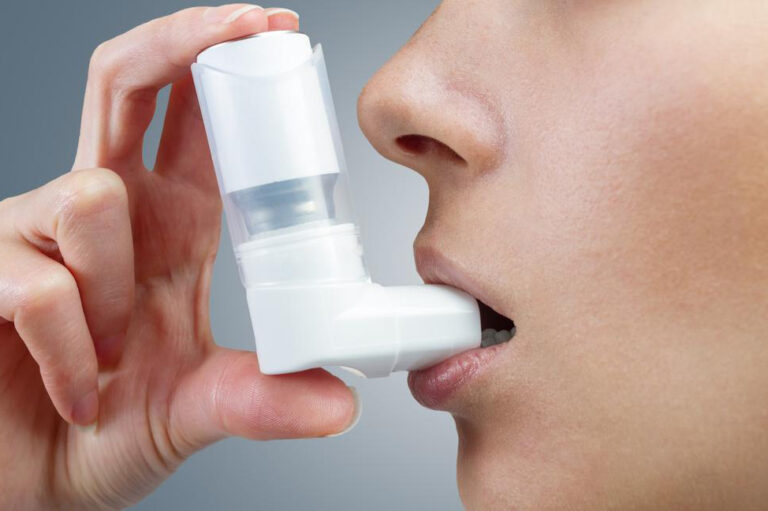 How is severe asthma treated?