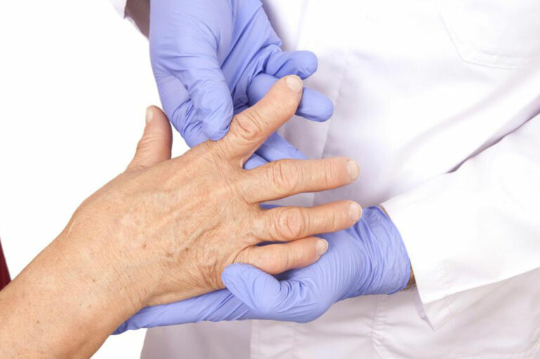 How to Detect the Early Signs of Rheumatoid Arthritis