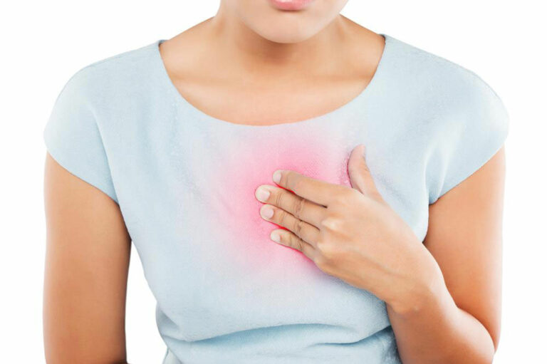 How to Treat and Prevent Heartburn and Indigestion