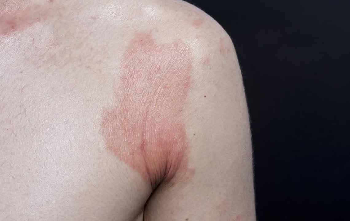 How to identify a skin rash