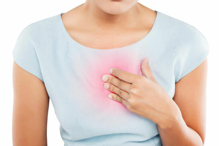 Important Things You Should Know About Heartburn Relief