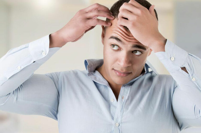 Important Things to Know about Thinning Hair Problem