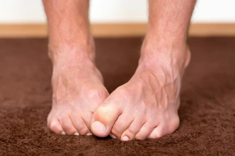 Important symptoms of neuropathy that should not be ignored