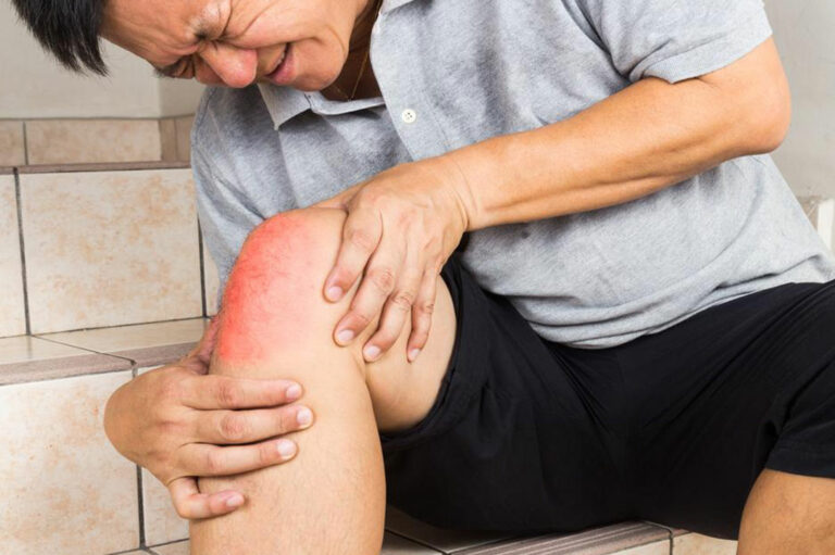 Joint pain &#8211; Causes and treatments