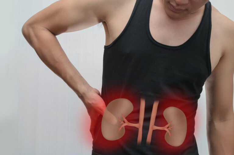 Kidney Failure &#8211; Causes and Symptoms