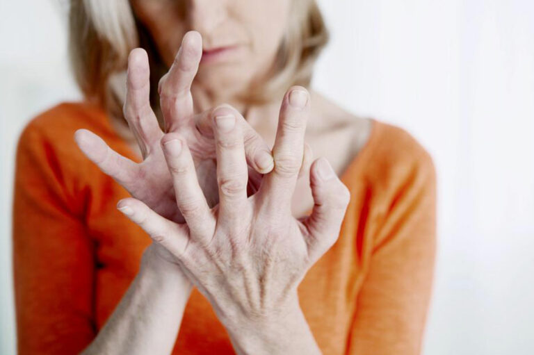 Know the Common Symptoms Of Rheumatoid Arthritis