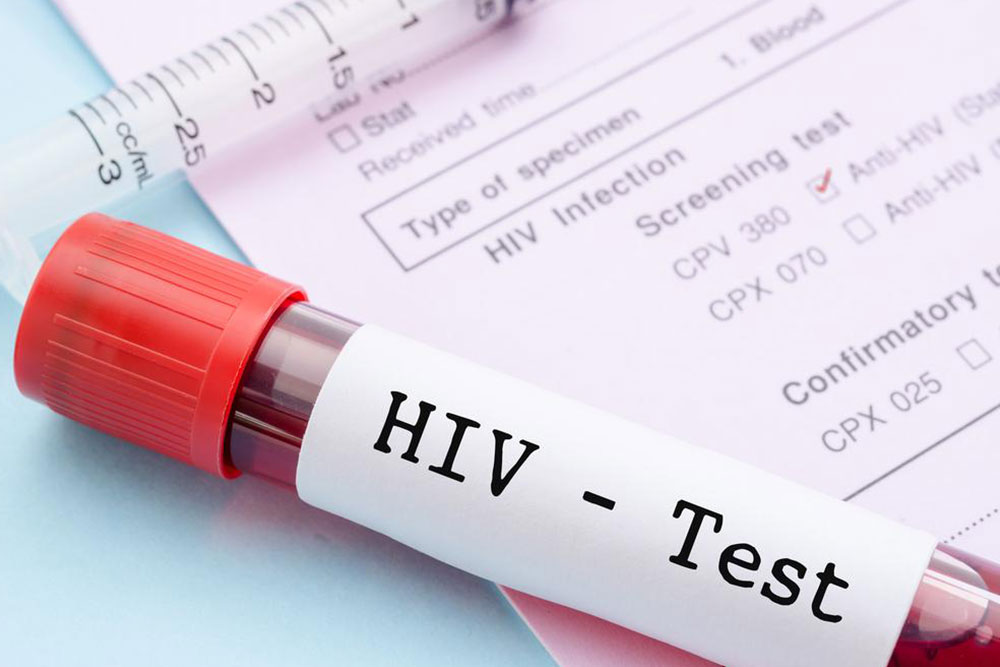 Know More About The Testing Of HIV