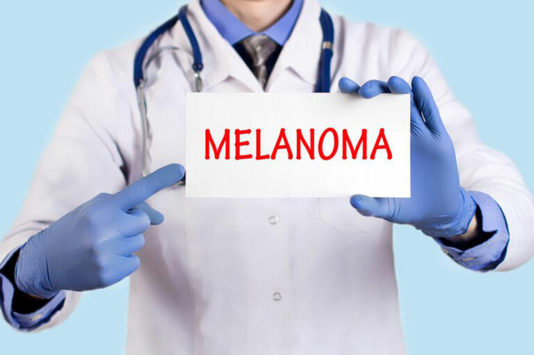 Know about the Diagnosis and Treatment Options for Metastatic Melanoma