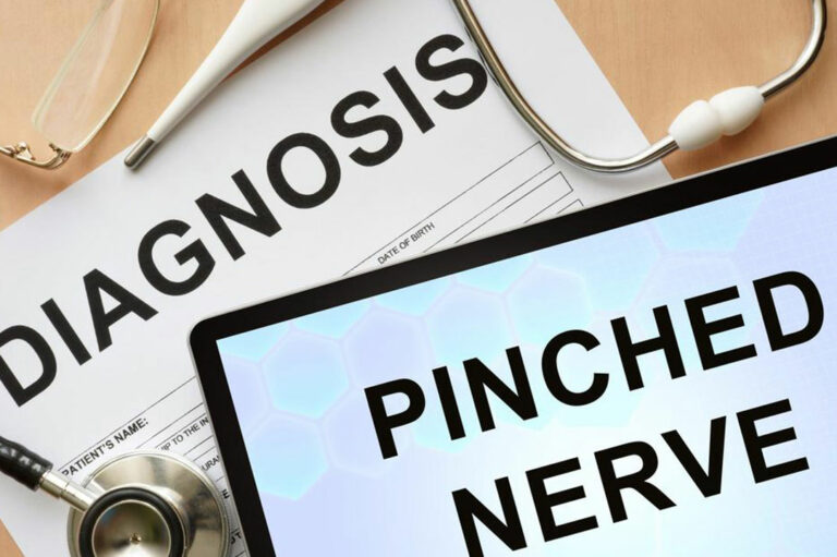 Know about the Pinched Nerve Treatment, Causes, and Symptoms