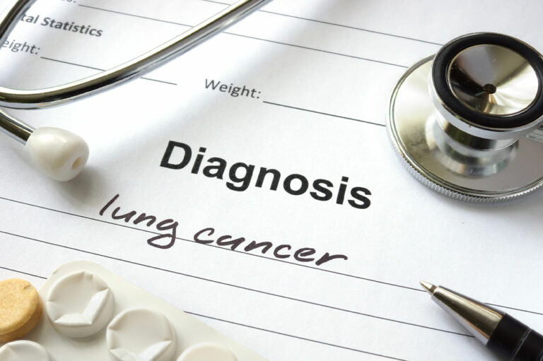 Lung Cancer &#8211; Types, Causes, and Symptoms