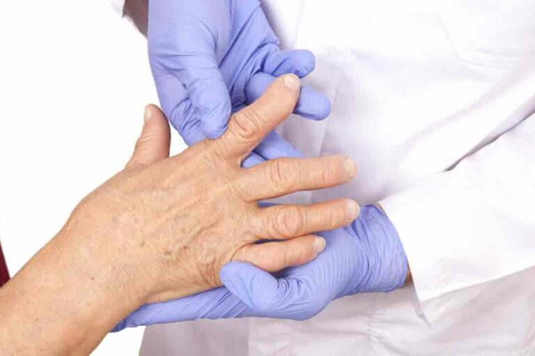 Rheumatoid Arthritis and Types of Doctors who can Undertake Treatment