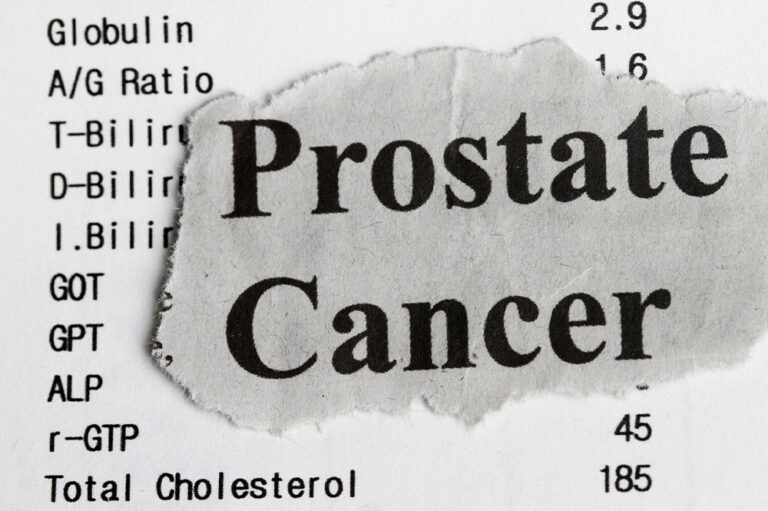 Stages, and Ways to Manage Prostate Cancer