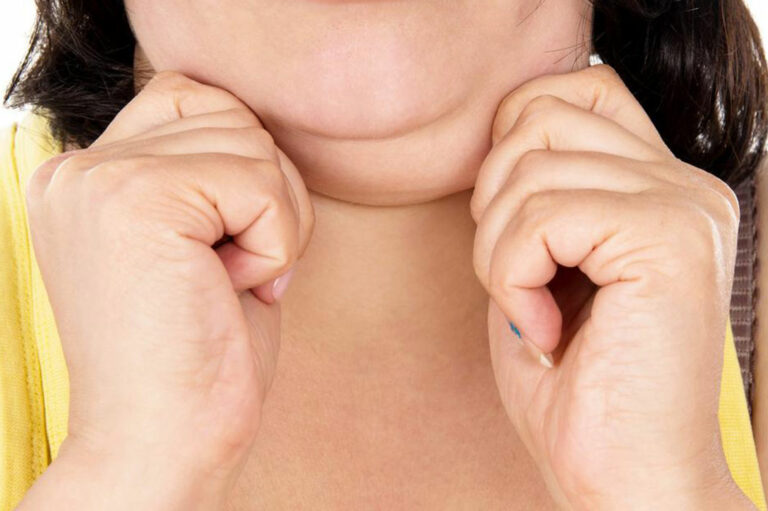 Struggling with a double chin? Here&#8217;s how you can get rid of it