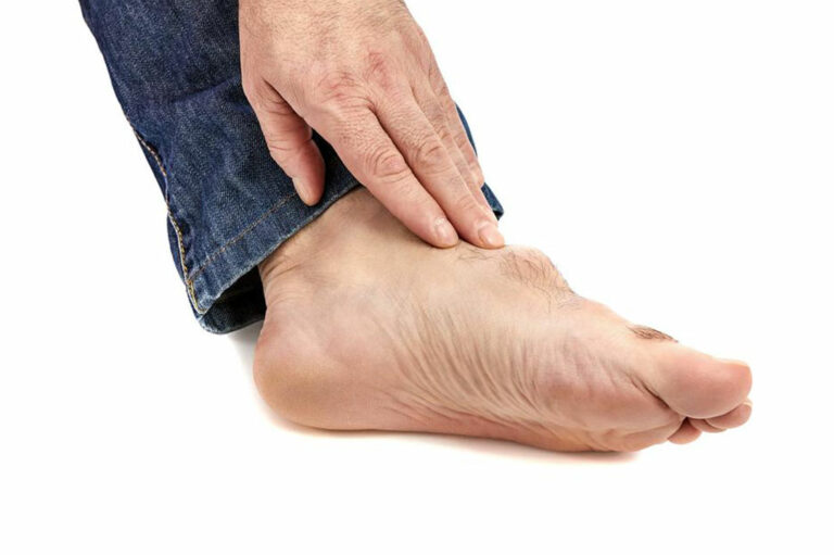 Symptoms, Causes, and Treatment of Gout