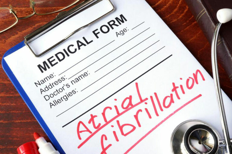 Symptoms, Diagnosis and Treatment of Atrial Fibrillation