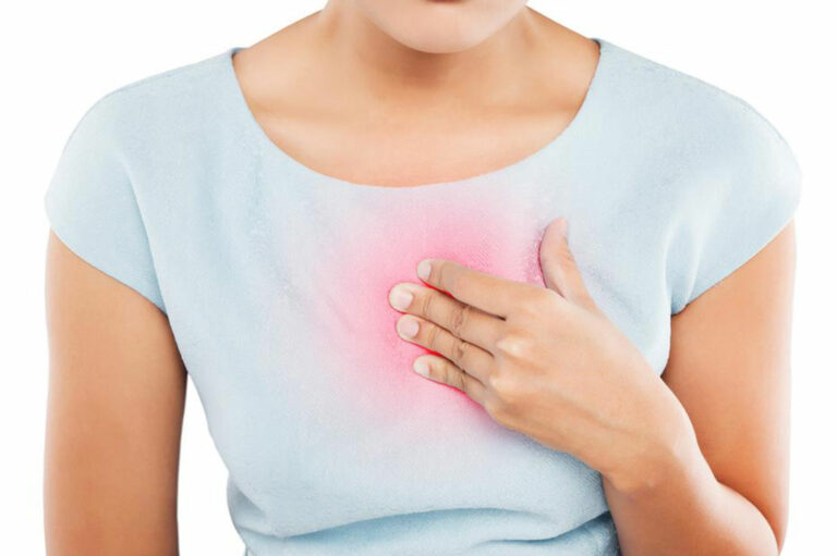 Symptoms of Heartburn and How to Treat It