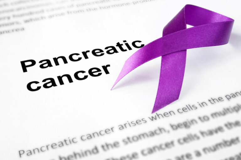 Symptoms of pancreatic cancer