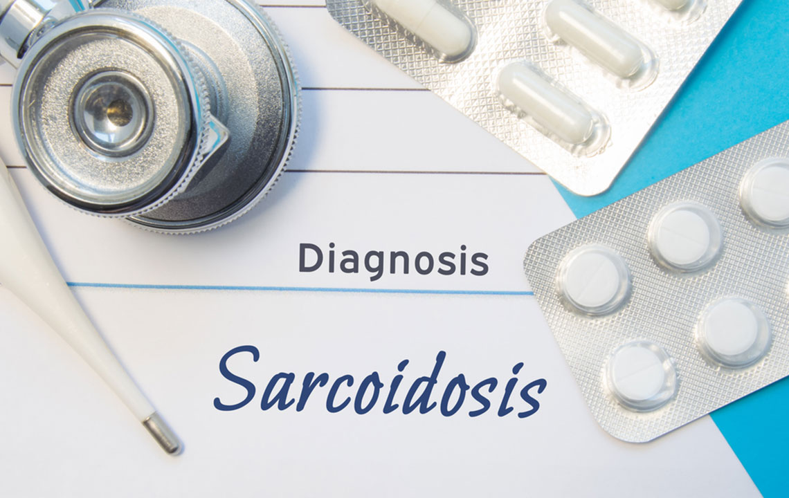 Sarcoidosis risk factors you should know about