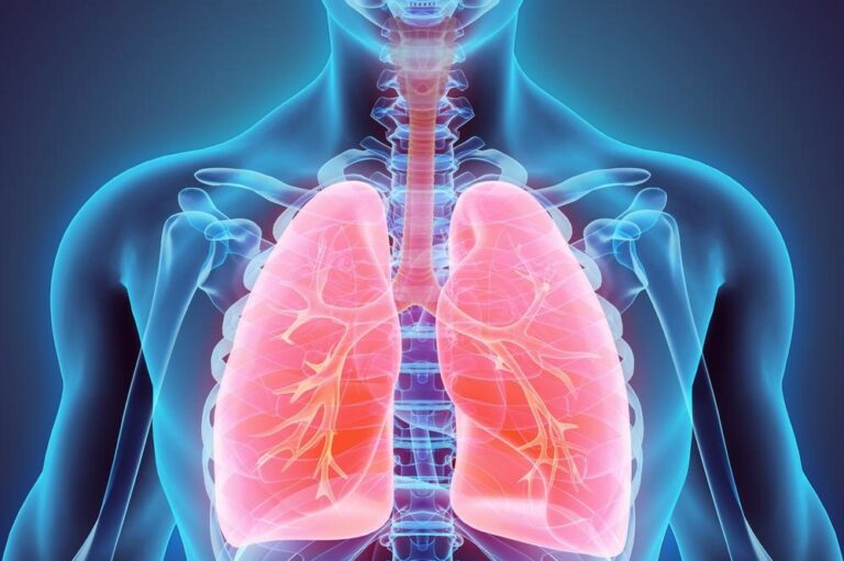 Signs and Symptoms of Lung Cancer