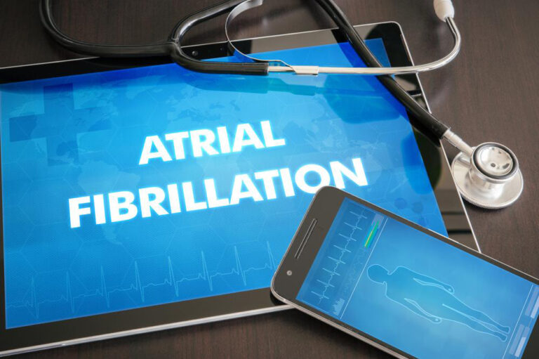 Signs and symptoms of Atrial Fibrillation and how to manage them