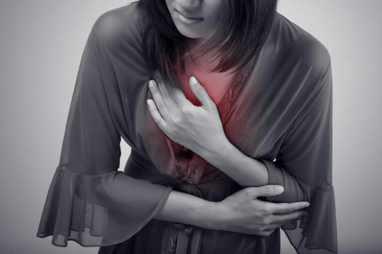 Simple Remedies to Stop Heartburn