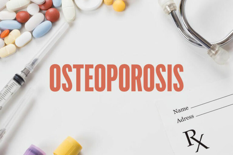 Ten steps to avoid or reverse osteoporosis