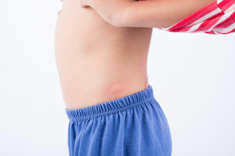 Ten types of skin rashes you should know about