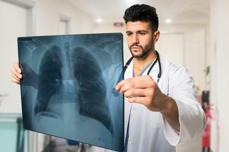 The 3 main signs of lung cancer