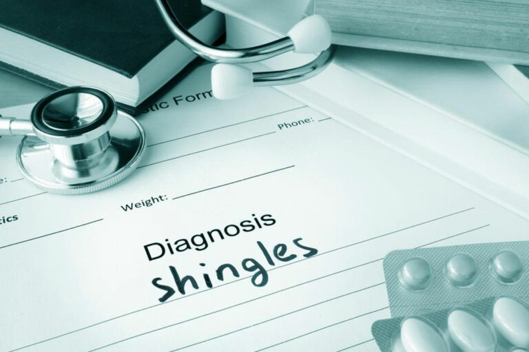 The Best Medication and Natural Treatments for Shingles