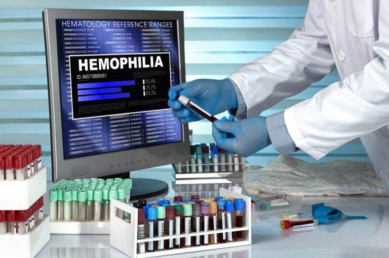 The Diagnosis and Prognosis of Hemophilia