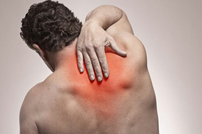 The Problem of Neck and Shoulder Pain