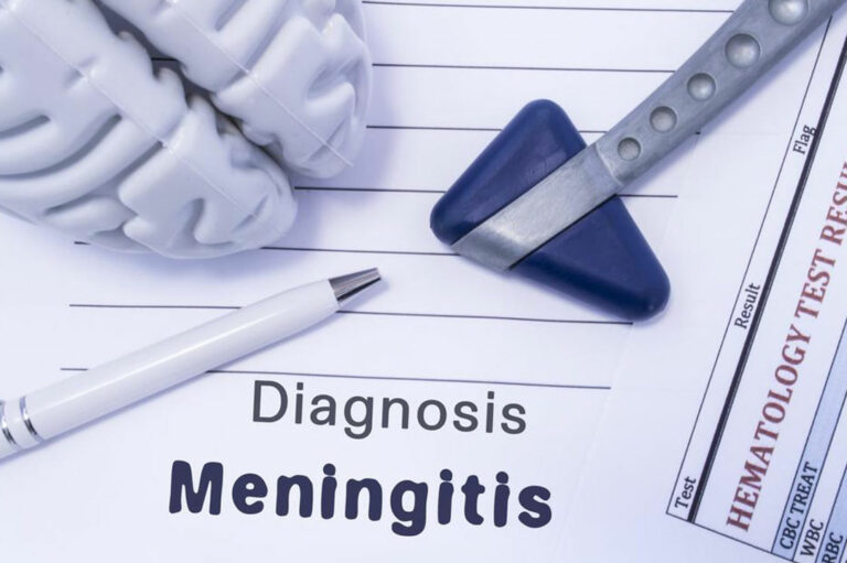 The What and Why of Strep Meningitis